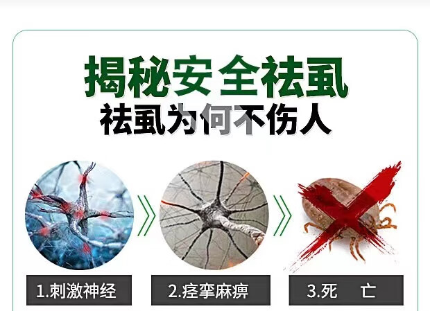 智猪五号去阴虱皇智虱子克星五号头虱一友猪5清虱三净念sal肤圣友套餐