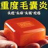 Dr. Shi Hong Kong genuine Mao Yanning shampoo soap purifies inflammation, repairs hair follicles, removes dandruff, relieves itching, removes mites, and controls oil. Buy 1 hair of 3. Head mites/itching/dandruff.