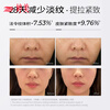 Tingmei (GRACWELL) face slimming bandage anti-gravity double chin tightening full face lifting and firming nasolabial folds anti-sagging face sculpting face slimming