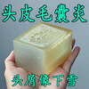 Dr. Shi Hong Kong genuine Mao Yanning shampoo soap purifies inflammation, repairs hair follicles, removes dandruff, relieves itching, removes mites, and controls oil. Buy 1 hair of 3. Head mites/itching/dandruff.
