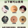 Xinlang plana warts, filiform warts, common warts, neck and armpit fleshy balls can be removed in one go without leaving any traces on the same day. Read the instructions carefully + online guidance, 5.m