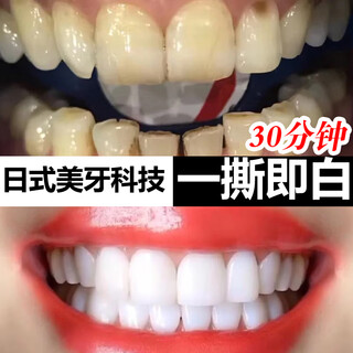 SMILEKIT日本美白牙贴去牙黄亮白牙齿白牙贴片美牙贴炫白酵素亮白锁白牙贴 1盒装【14片装=7对】