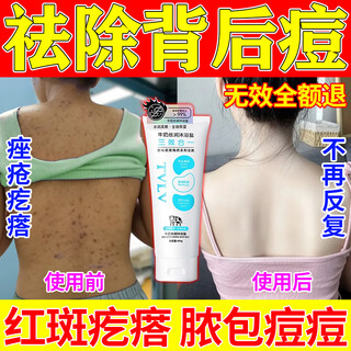 Bath salts for bathing, anti-inflammation, sterilization and anti-itching, milk bath salts, general purpose for removing back acne, keratin and mites, 400g 1 tube, sterilization and anti-itching