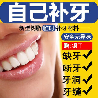 Filling material for filling holes. self-filling adult resin filling tool. dental repair filler. 2 packs. can fill 20 teeth.