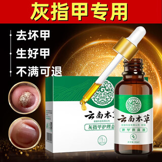Yunnan materia medica special effect chinese herbal antibacterial liquid for onychomycosis, thickening, yellowing and empty, anti-analysis water, special effect kit for onychomycosis