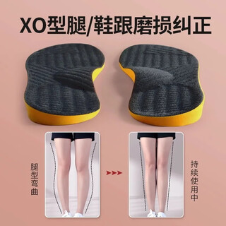Weidai corrective insoles for men and women, beautiful legs, inside and outside, flat feet, o-shaped feet, arches,