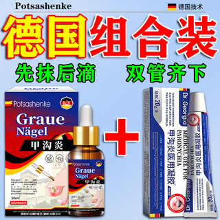 Hengqi paronychia special removal root i cure toenails grow into the flesh, reduce swelling and pain, remove granulation buds and treat severe polyps and ingrown toenails. imported from germany, 1 box of cream + 1 box of liquid, super special effect pack, must be removed. repeated paronychia, polyps are red, swollen, inflamed, draining and embedded with pus. special external anti-inflammatory plaster.
