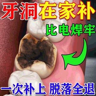 Filling materials for filling teeth at home. high hardness resin fills gaps between teeth. repairs gums and cavities. it is not afraid of being burned. three bottles are available at a discount.