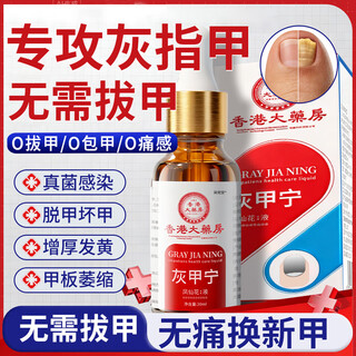 Layanana special effect on onychomycosis, special use of yellowing and thickening root cream to treat nail infection, removal of onychomycosis and bactericidal liquid cream 30ml