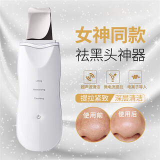 Ultrasonic blackhead remover instrument for cleaning pores and peeling machine, beauty instrument, household face scraper, white