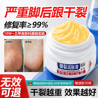 Beai chapped feet cream heel anti-dry cracks chapped cracks frosted crack cream protects chapped hands and feet moisturizer