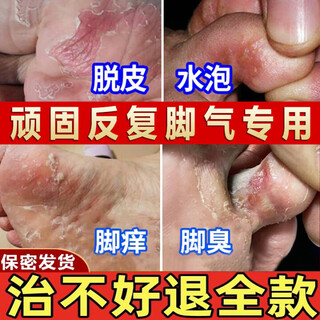 Lejia's old store nanjing tongrentang removes athlete's foot, foot odor, soothes itching, rotten foot skin, fungal infection, skin antibacterial