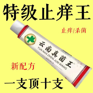Yunnan antipruritic king special effect skin itching external use whole body skin dry itching hands and feet fungus antipruritic cream sterilization 29/棓 effect a box expensive in shipping costs