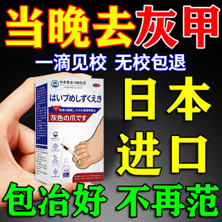 Tosagawada onychomycosis no. 1 special effective nail fungus infection de-onychomycosis i treatment genuine imported severe special effect one box