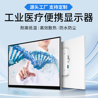 Weichensi medical grade portable touch screen monitor hospital imaging fetal detection surgery endoscopic diagnostic equipment oral ent ophthalmology orthopedics b-ultrasound triage medical monitor 21.5 inches 1080p non-touch ceramic white yf21