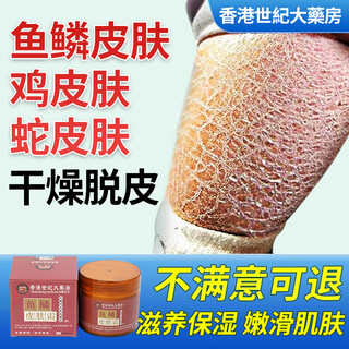 Hong kong pharmacy fish scale skin moisturizing cream snake skin leg texture special hair follicle keratosis peeling skin moisturizing body lotion package 1 box (100g) initial effect fading lines