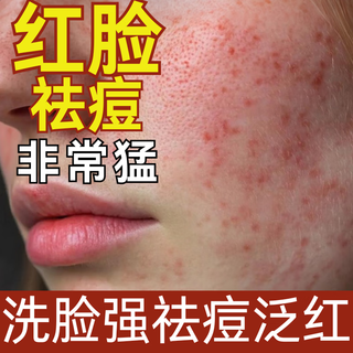 同仁堂洗面奶祛痘男女士通用控油水杨酸氨基酸黑头痘印少年青春痘洁面乳