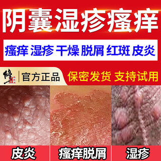 Correct the moist and itchy scrotum, scrotal inflammation, testicular itching, eczema cream, anus and inner thigh skin itching, relieve itching for men. an initial set (double-effect type) for moist and itchy men's private parts, special anti-itching and root removal.