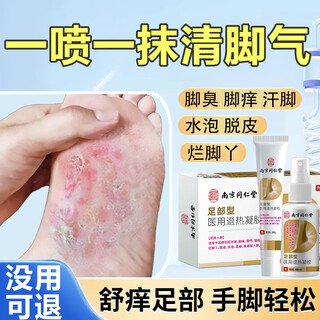 Tongrentang athlete's foot spray anti-itching peeling feet sweat soak type itchy feet smelly sweat spray wolfsbane spray 60ml+20ml