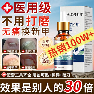Tongrentang special plaster for non-severe onychomycosis, nail fungus infection, non-imported onychomycosis, impatiens antibacterial liquid, one onychomycosis, one box is enough, one box