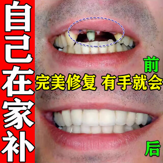 Tooth filling artifact material: self-filling resin at home, tooth repair gel, medical high hardness, 1 box trial pack, can fill 10 teeth