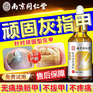 Tongrentang onychomycosis special nail fungus infection removal, bad nails, bright nails, onychomycosis, net yellowing, thickening and empty 30ml