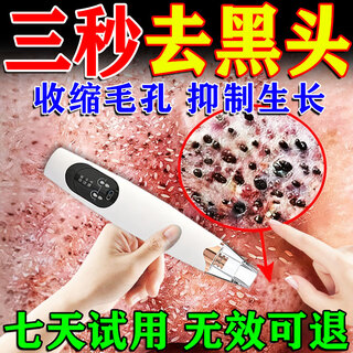 Qiaocheng blackhead suction instrument cleaner beauty salon special household large suction blackhead acne cleaning artifact for men and women white standard model vacuum negative pressure / suck out blackheads