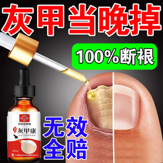 Baiyunshan huacheng onychomycosis 100% special effect medicated nail fungal infection removal and onychomycosis thickening onychomycosis antibacterial potion special effect one box