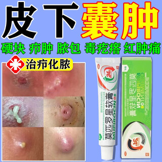 Mupirocin ointment, sebaceous cyst ointment, can be used to see the face, remove subcutaneous acne, powdery tumor hyperplasia, redness, inflammation, boils, poisonous pimples, pustules, anti-inflammation, treat pustules, poisonous boils, 2 boxes of red pimples and swelling on the body