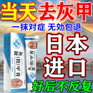 Miyamoto's onychomycosis 100% effective special medicine for severe onychomycosis fungal infection, nail removal, thickening, bad nail cream, antibacterial liquid 1 box, onychomycosis cream, no. 1 onychomycosis special effect