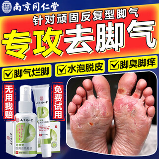 Tongrentang athlete's foot spray to relieve itching, peeling, rotten feet, fungal infection, sweaty feet, foot odor and blisters, special spray to treat wolfsbane spray