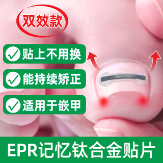 Dr.jys paronychia corrector titanium silicone model special nail patch for ingrown toenails