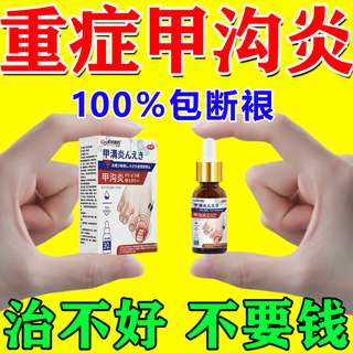 100% special treatment for paronychia, detumescence, pain relief, granulation removal, severe polyps, nail ingrown toenail correction device 30ml 1 bottle, special effect solution for paronychia
