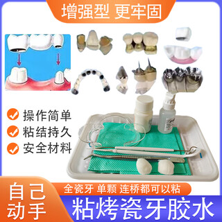 Yusenyi special glue for adhesive teeth, self-adhesive porcelain teeth, all-ceramic braces, crowns and bridges, dental cavity repair adhesive, 2 bottles of oral liquid (110ml)