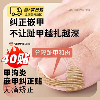 Gemeng nail groove corrector patch inflammation ingrown toenail artifact to prevent toenails from growing into the flesh special isolation tool filling gasket