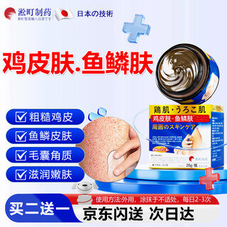 Songding pharmaceutical chicken skin removal artifact removes chicken skin, body hair follicles, keratin pimples, thigh keratosis, special non-plague
