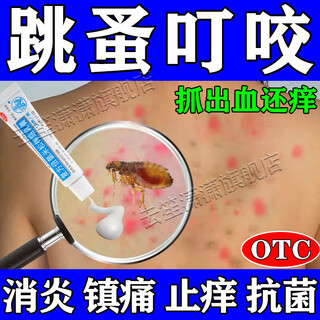 Flea medicine for humans to relieve itching, ointment to treat flea bites, ointment for children to relieve itchiness and reduce swelling caused by poisonous insect bites, compound beclomethasone camphor cream 1 1 box, flea bites, reduce swelling and relieve itching, order free cotton swab jd.com