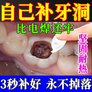 Tooth filling material, self-filling artifact, tooth repair, filling between teeth, cavity, temporary front tooth repair and filling, bottle of filling artifact