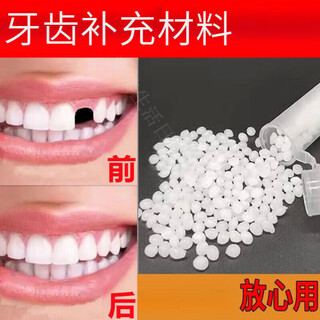 Modou shenghuo artifact tooth filling at home dental cavity paste gap material braces fills the gaps of false teeth 15 times (comes with tutorial + tool kit)