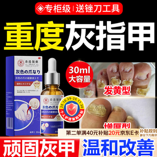 Dr. xin's onychomycosis specializes in treating severe nail infections with yellowing and thickening root cream 30ml