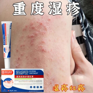 Hong kong pharmacy eczema ointment eczema skin itching dermatitis eczema fungal infection anti-itching psoriasis scrotum anus moist itching single box experience pack mild eczema