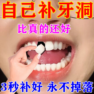 Filling materials, imported resin, self-filling artifact, plugging holes and repairing teeth, adult tooth decay repair filler, 1 box, trial pack