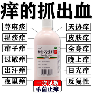 Special anti-itching medicine for skin, anti-itching skin itching, body itching, skin itching, dermatitis, eczema, fungi, stubborn eczema, anti-itching, removing the root of the disease, calamine lotion, for adults and babies, 1 box, 3 boxes, severe itching, waking up in the middle of the night due to itching, starting from the root, fat dong