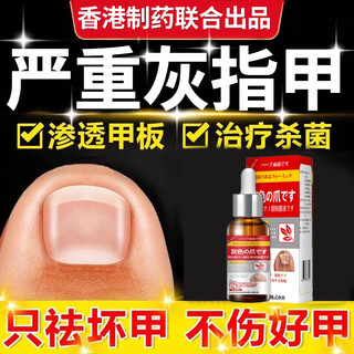 Dr. xin's onychomycosis specially used for severe nail infections to remove onychomycosis, yellowing and thickening liquid root cream 30ml