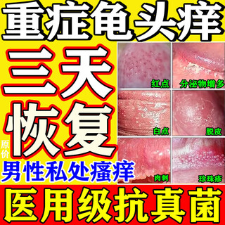 Official special medicine for balanitis, reproductive fungal infection, anti-inflammatory, pearly rash, foreskin inflammatory disease, men's private parts itching, male skin medication, erythromycin ointment, 10 boxes, jingdong pharmacy