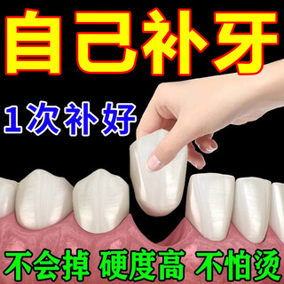 Tooth filling material, filling hole artifact, self-filling gap between missing teeth, large denture braces, simulated resin glue filling repair agent, 1 box trial pack, tooth filling artifact