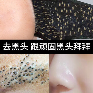 Nanjing tongrentang blackhead remover nose patch repair pore shrink cleansing mud mask blackhead cleaner peel-off mask 100g chinese valentine's day