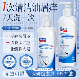 Yingfeng international selenium disulfide shampoo anti-dandruff, anti-itch, oil-control, long-lasting fluffy shampoo, folliculitis, seborrheic skin oxygen dew agent