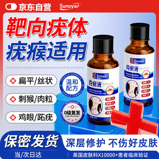 Sunoyar wart exfoliation cream special for flat warts, filamentous condyloma acuminata, plantar warts, neck warts, small meat grains, 1 bottle of wart liquid