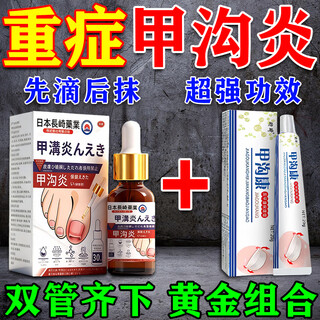 Hengqi paronychia special removal root i cure toenail growth, reduce swelling and pain, remove granulation buds and treat severe polyps and ingrown toenails. imported from japan. 1 box of cream + 1 box of liquid. special effect combination pack. repeated paronychia polyps are red, swollen, inflamed, draining and embedded with pus. special external anti-inflammatory plaster.